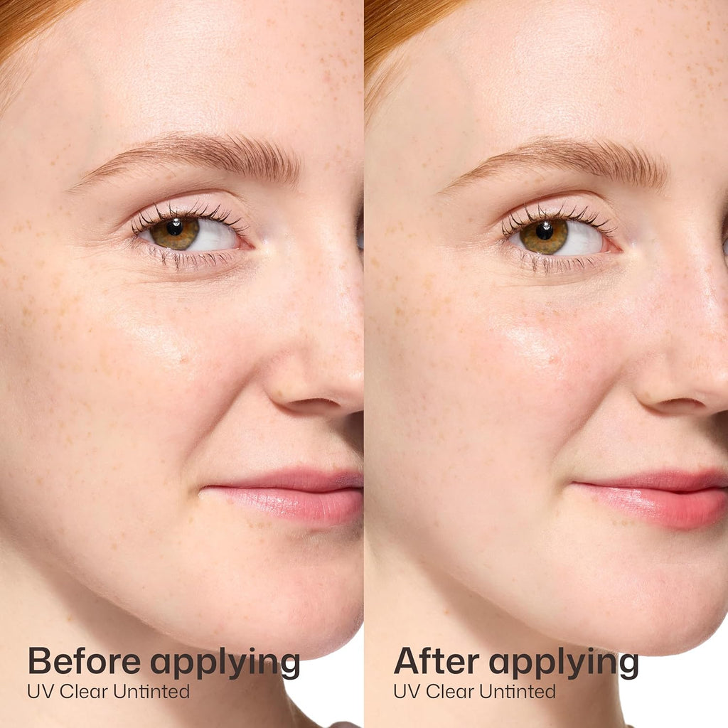 EltaMD UV Clear Face Sunscreen SPF