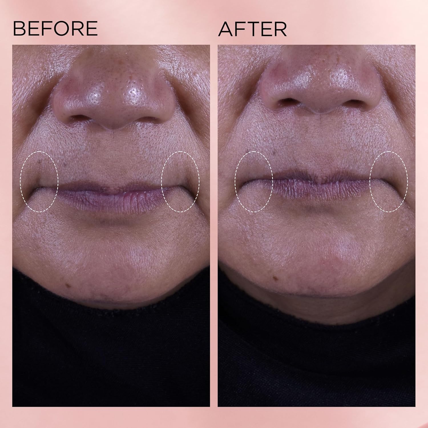 Elizabeth Arden Retinol + HPR Ceramide Rapid Skin Renewing Water Cream