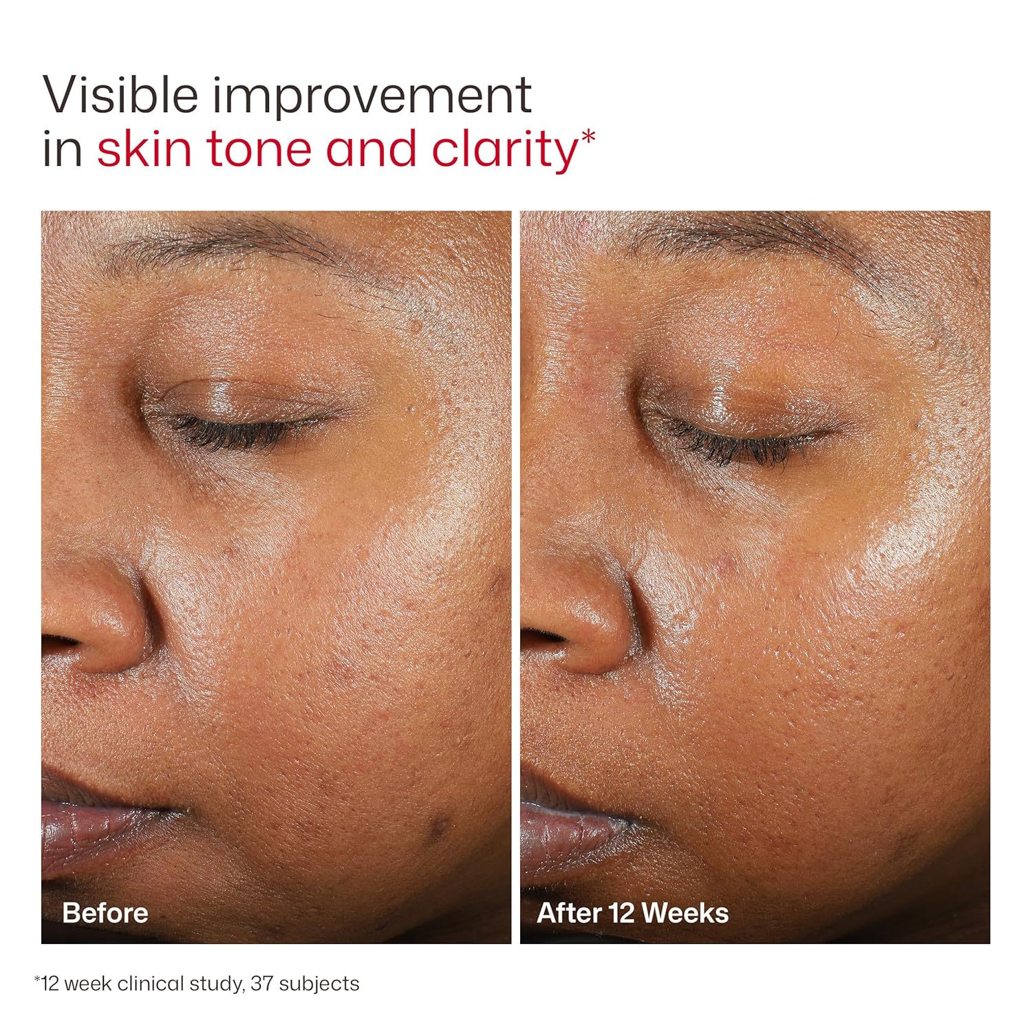 EltaMD UV Clear Face Sunscreen SPF